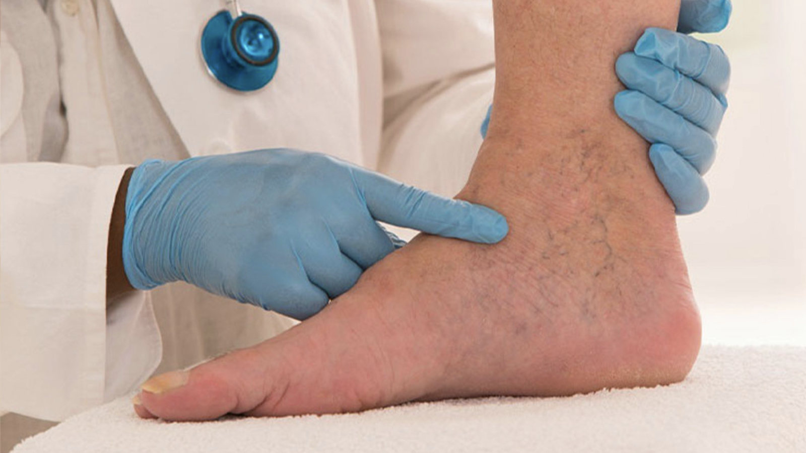 bacakta sislik ve agri hissedenler dikkat derin ven trombozunun isaretcisi olabilir cbNi6NZM